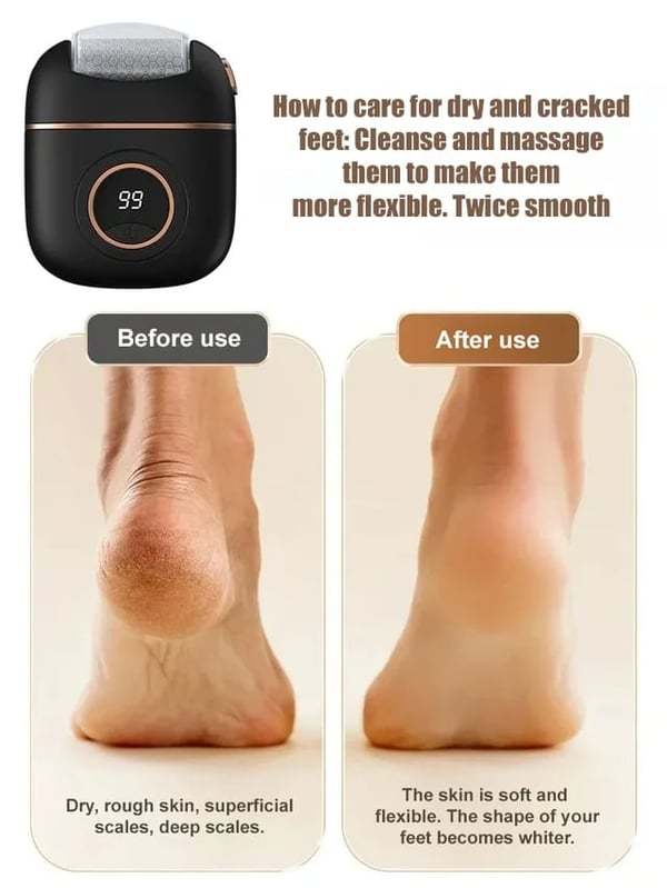 ⏰New Digital Electric Foot Polisher
