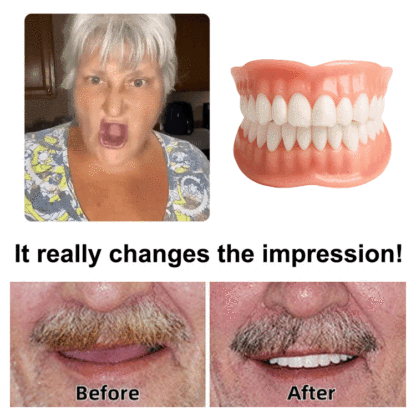Denture Retouching Beauty Kit-Recommended by dentists, solves 99% of dental issues!