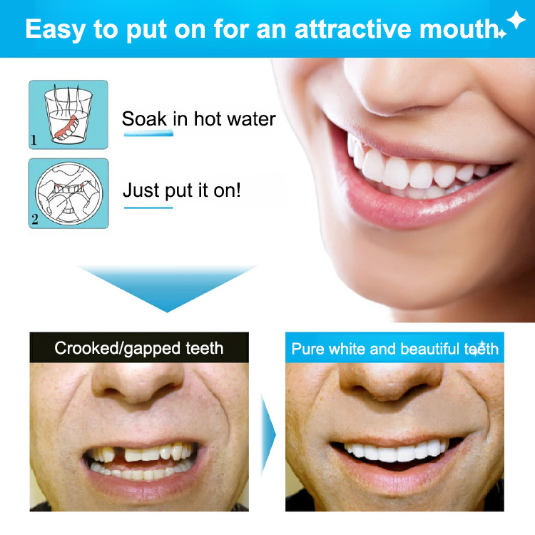 Denture Retouching Beauty Kit-Recommended by dentists, solves 99% of dental issues!