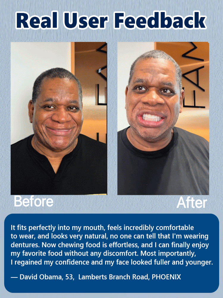 【FDA Certified & Million Positive Reviews】Full Mouth Suction Dentures