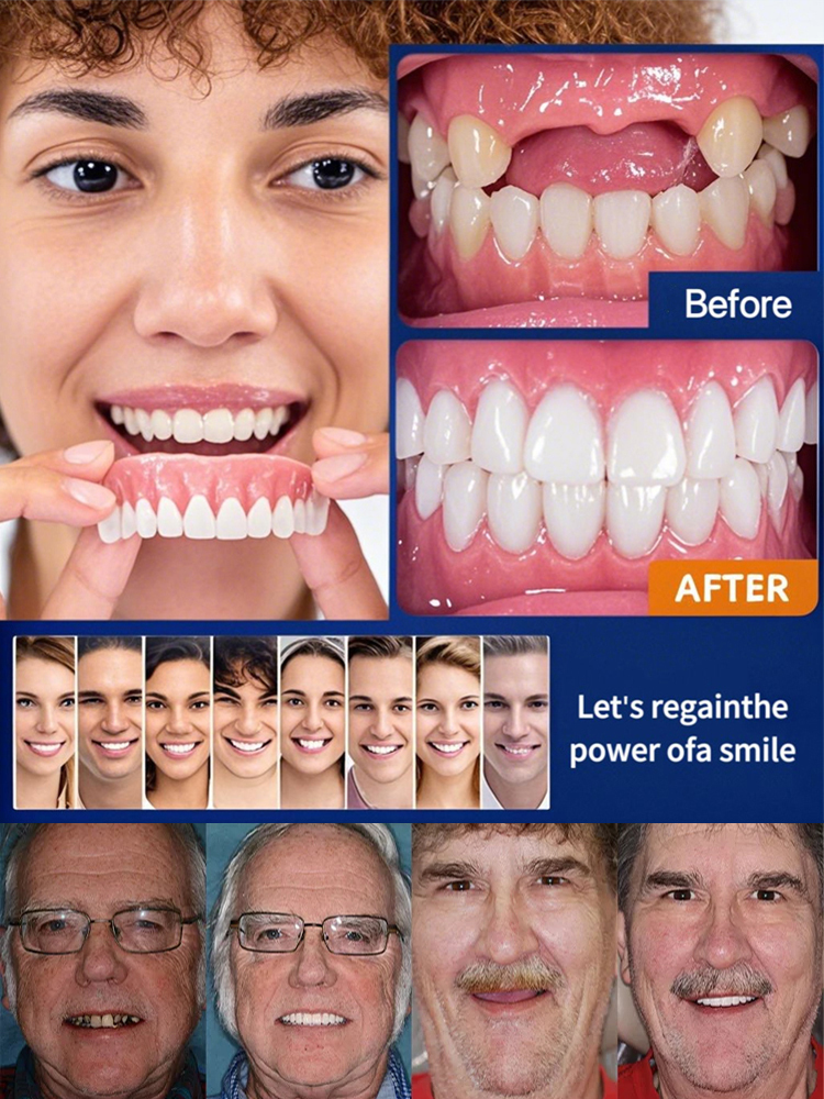 【FDA Certified & Million Positive Reviews】Full Mouth Suction Dentures