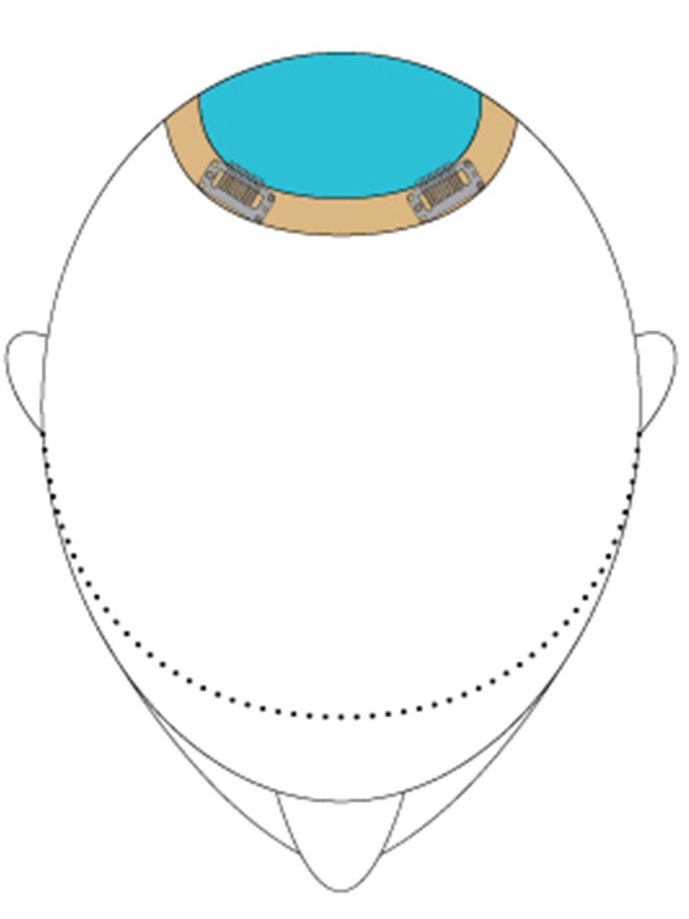 Top This 8" | Remy Human Hair Topper-Lelony