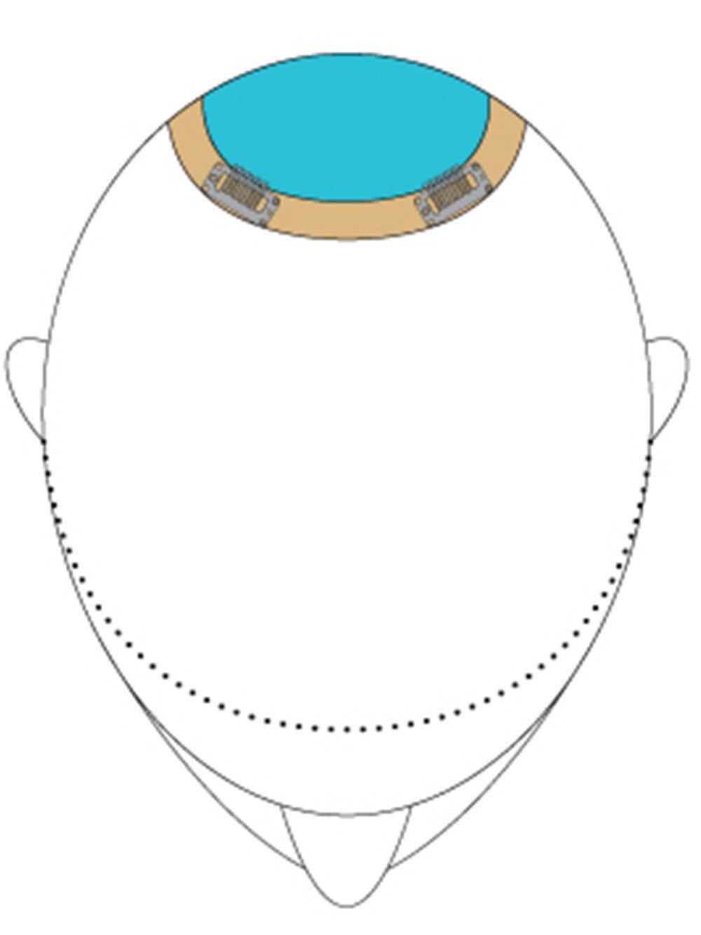 Top This 12" | Remy Human Hair Topper-Lelony