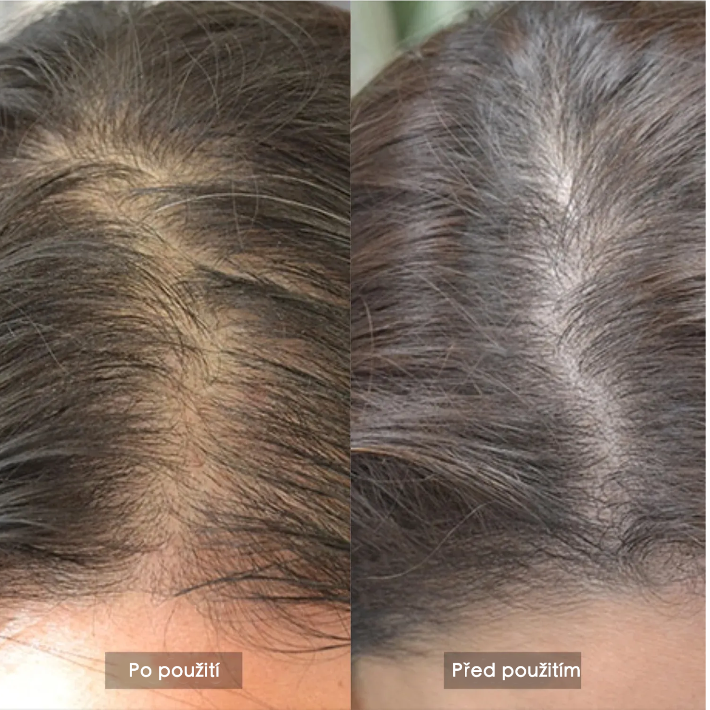 Růstová laserová a LED čepice VeonSkin GrowMax