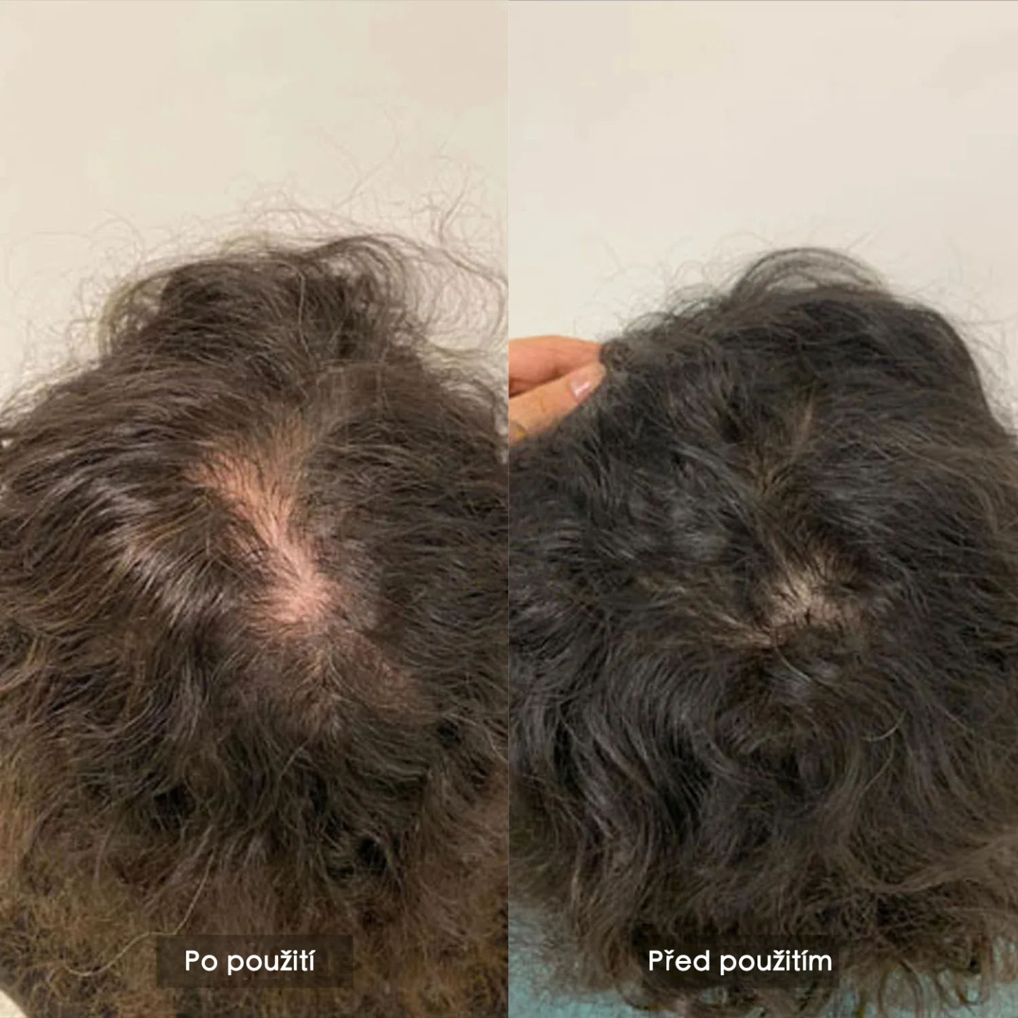 Růstová laserová a LED čepice VeonSkin GrowMax