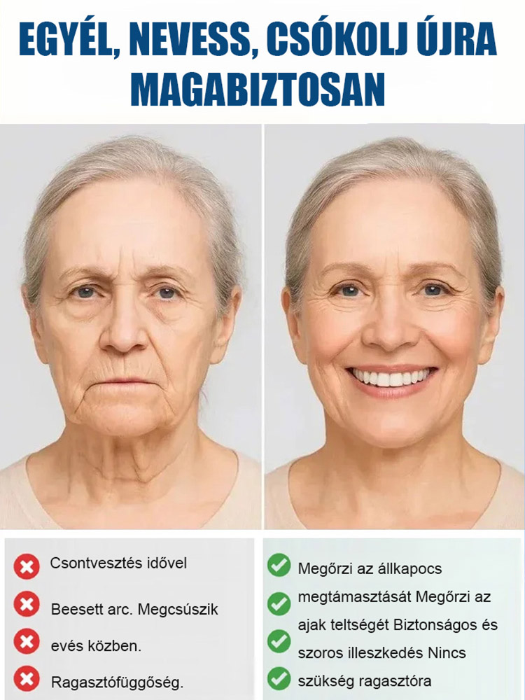 【Több mint 300 000 felhasználó világszerte】Teljes szájcsontváz-fogsor-támogató készlet