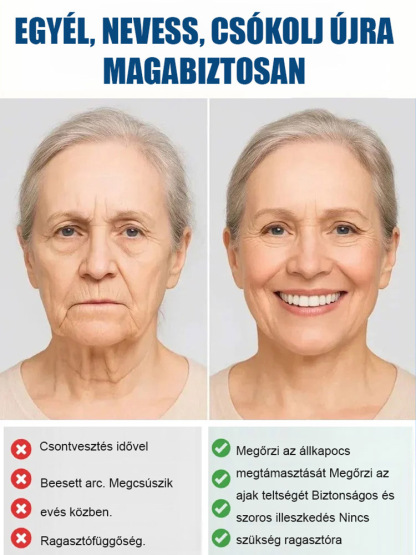 【Több mint 300 000 felhasználó világszerte】Teljes szájcsontváz-fogsor-támogató készlet