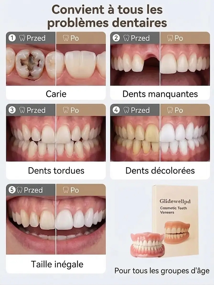 Dentiers complets tout inclus, amélioration épique, port confortable