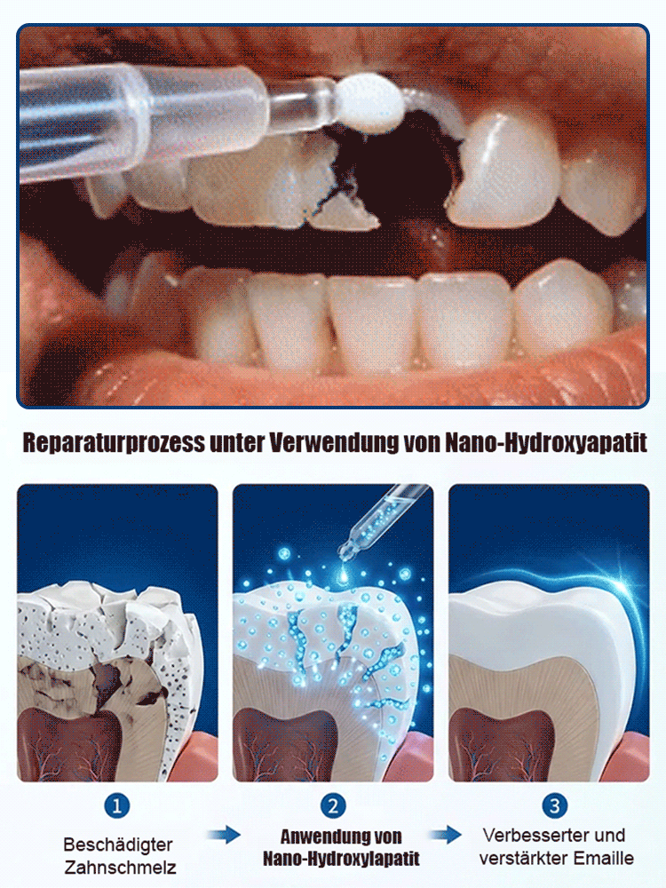😱DAS wollen Zahnarztpraxen nicht verbreiten!【Abschied von Zahnprothesen & neues Zahnwachstum】Natürliches Zahnwachstums-Pflegefluid
