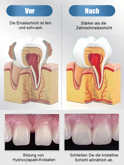 😱DAS wollen Zahnarztpraxen nicht verbreiten!【Abschied von Zahnprothesen & neues Zahnwachstum】Natürliches Zahnwachstums-Pflegefluid