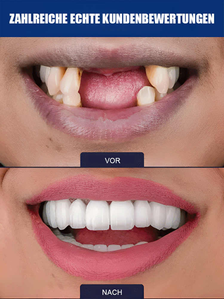 😱DAS wollen Zahnarztpraxen nicht verbreiten!【Abschied von Zahnprothesen & neues Zahnwachstum】Natürliches Zahnwachstums-Pflegefluid