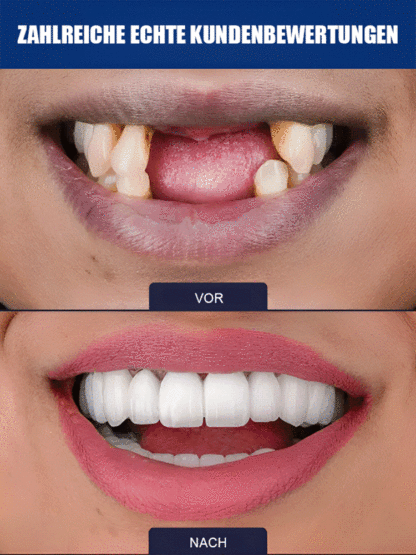 😱DAS wollen Zahnarztpraxen nicht verbreiten!【Abschied von Zahnprothesen & neues Zahnwachstum】Natürliches Zahnwachstums-Pflegefluid