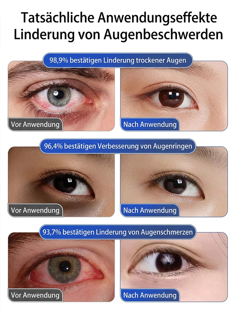 ⚡Ernte in nur 60 Tagen!【Importierte neue Sorten】Pink Lady Blaubeerbaum-Sämling | 🌟Extra groß, extra süß, extra knackig | ✅100 % Anwuchs-Garantie