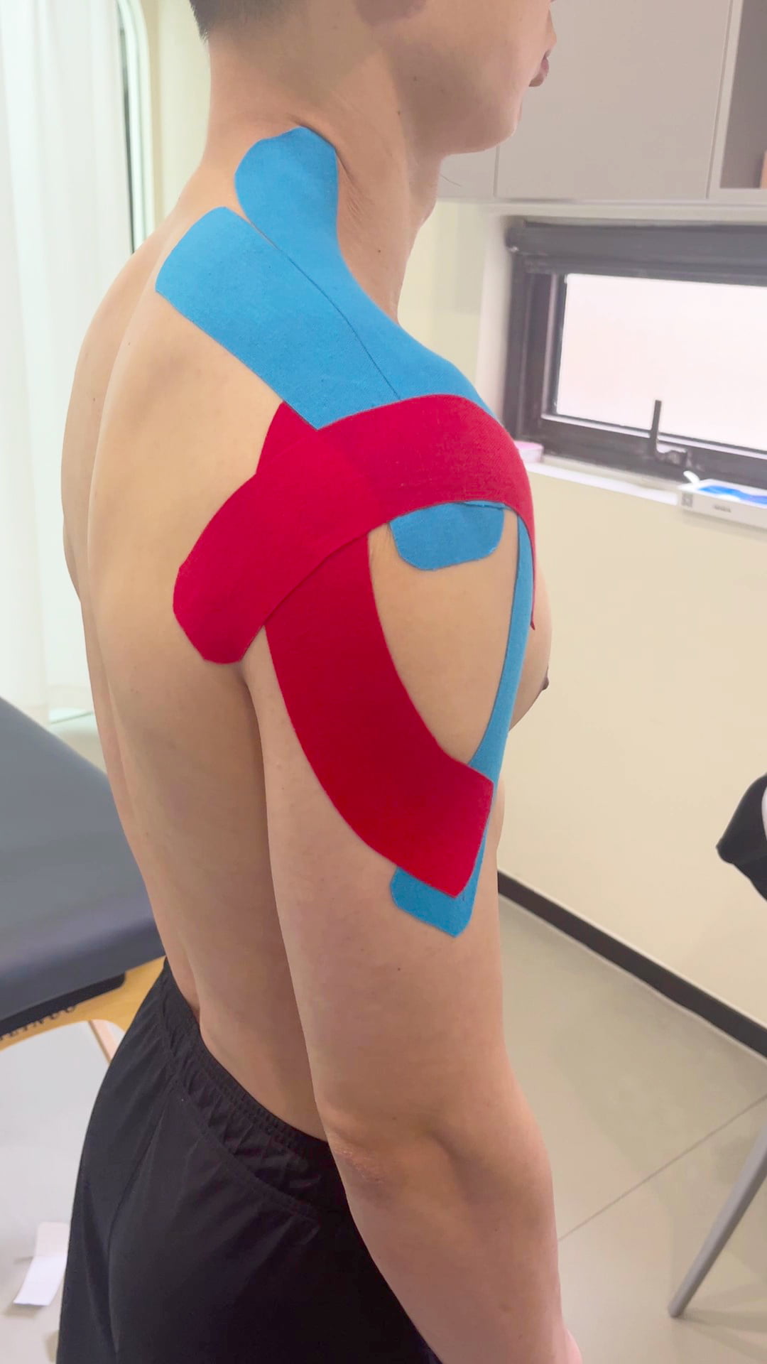 {"default":"kinesiology tape for AC joint"}
