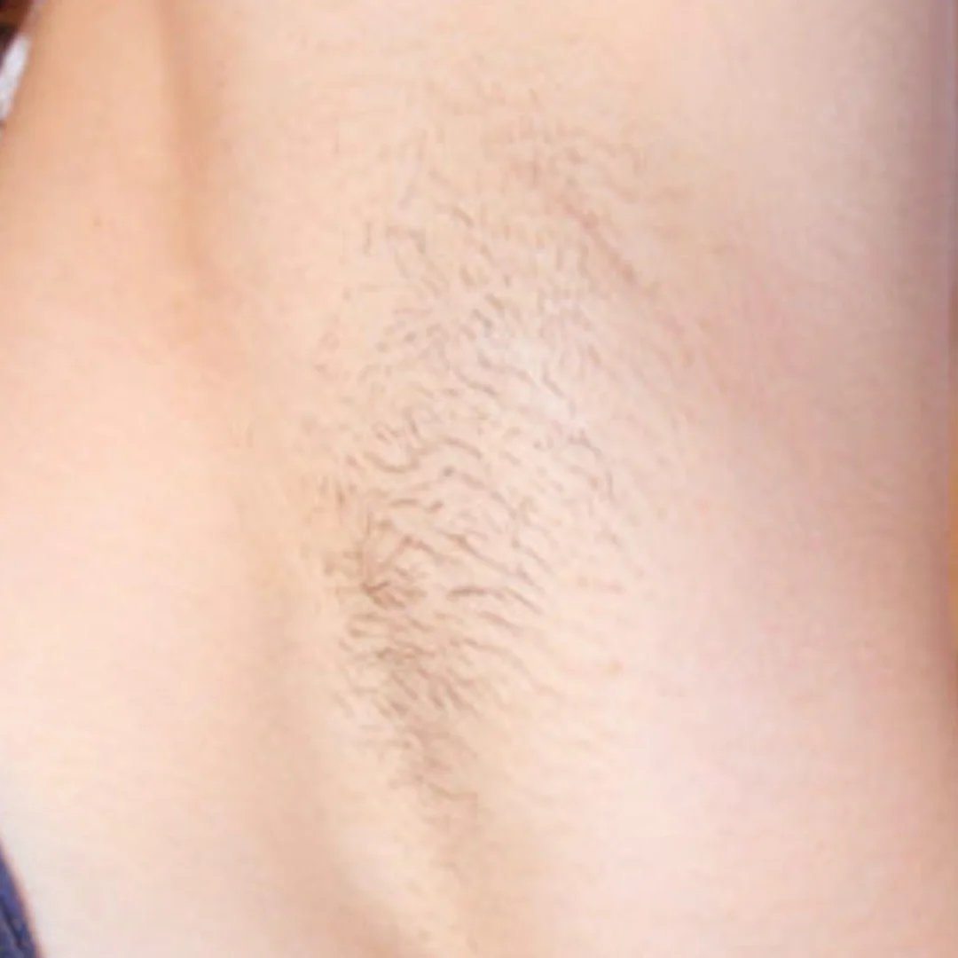 Hair