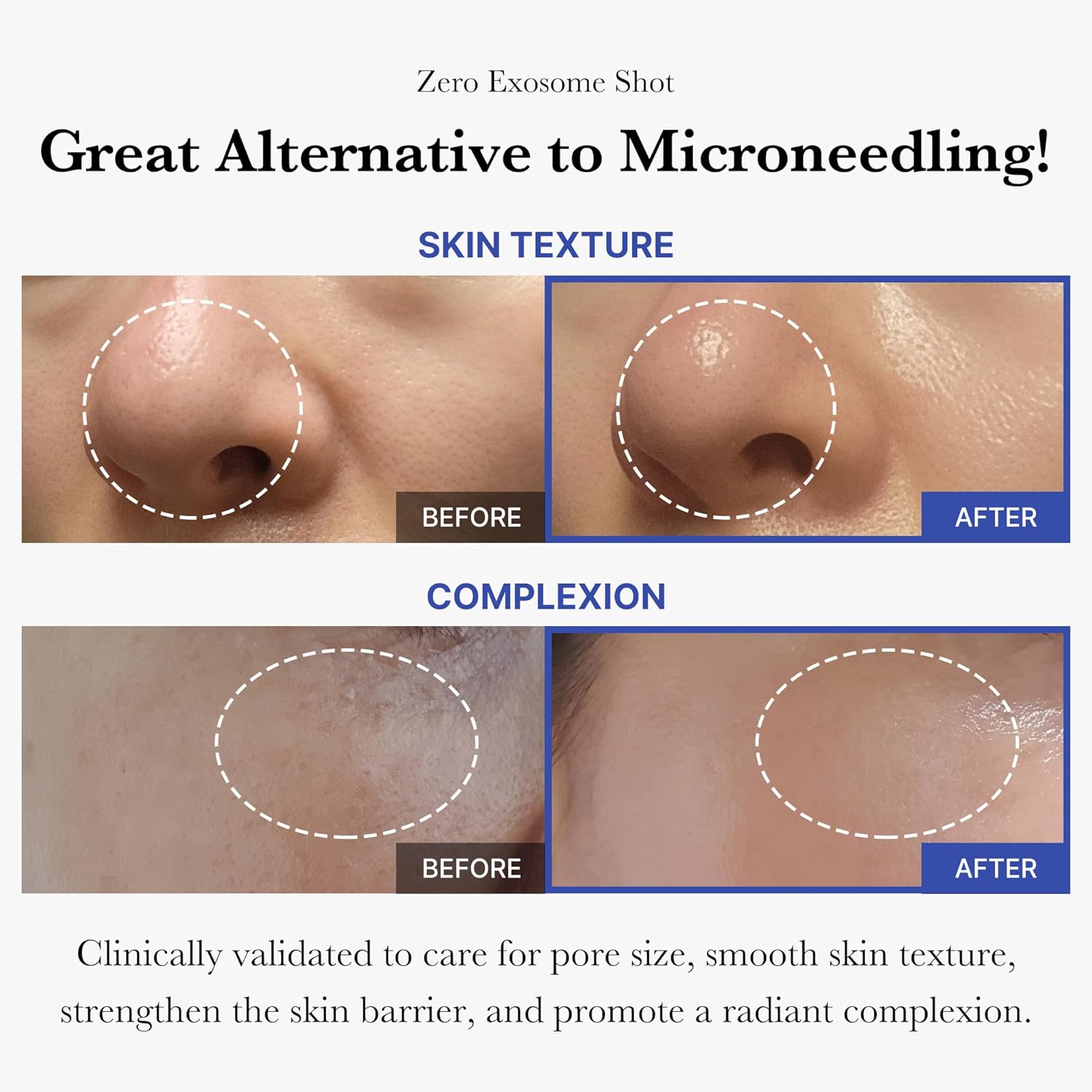 Zero Exosome Spicule Shot Serum 2000 mild Skincare Aha Ampoule