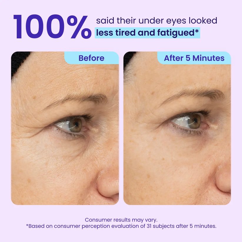 🏆 Top Rated! 80K+ SOLD! ⚡ Flash Sale: GOPURE™ Instant Lift Eye Gel. Say goodbye to bags & wrinkles！🕒 
