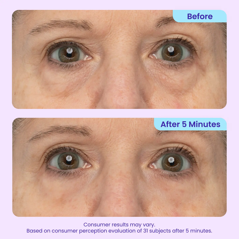 🏆 Top Rated! 80K+ SOLD! ⚡ Flash Sale: GOPURE™ Instant Lift Eye Gel. Say goodbye to bags & wrinkles！🕒 