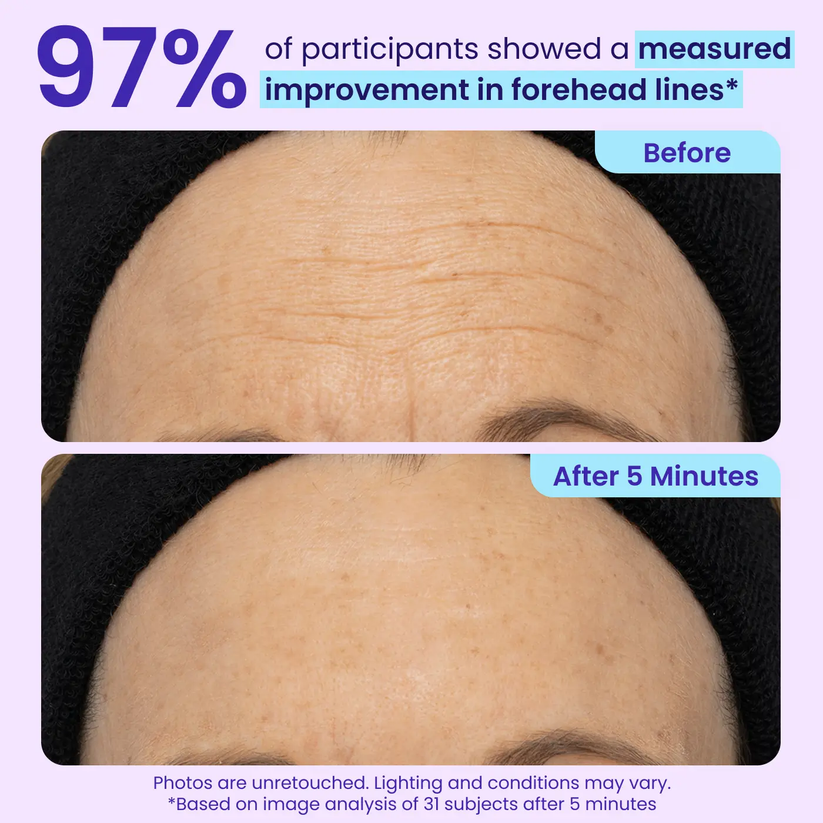 🏆 Top Rated! 80K+ SOLD! ⚡ Flash Sale: GOPURE™ Instant Lift Eye Gel. Say goodbye to bags & wrinkles！🕒 