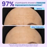 🏆 Top Rated! 80K+ SOLD! ⚡ Flash Sale: GOPURE™ Instant Lift Eye Gel. Say goodbye to bags & wrinkles！🕒 