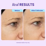 🏆 Top Rated! 80K+ SOLD! ⚡ Flash Sale: GOPURE™ Instant Lift Eye Gel. Say goodbye to bags & wrinkles！🕒 