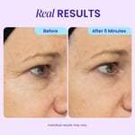 🏆 Top Rated! 80K+ SOLD! ⚡ Flash Sale: GOPURE™ Instant Lift Eye Gel. Say goodbye to bags & wrinkles！🕒 