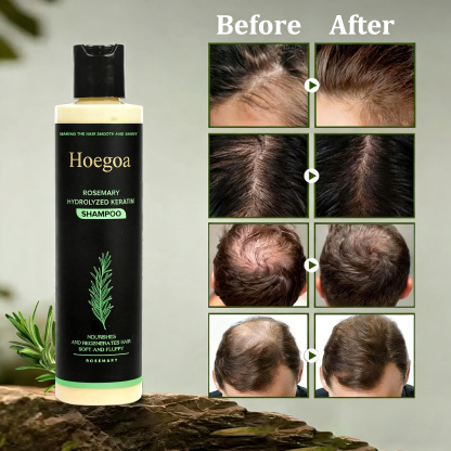 Tgideas Organic Rosemary Hair Growth Shampoo 