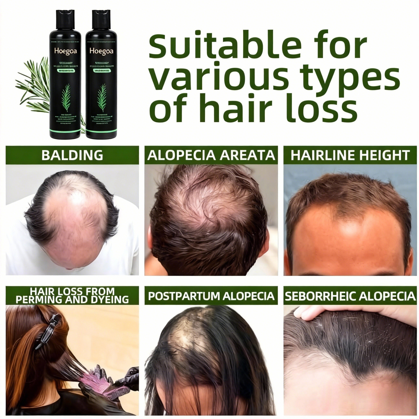 Tgideas Organic Rosemary Hair Growth Shampoo 