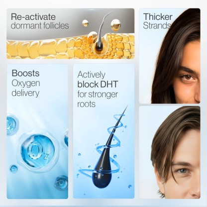 Aparthy Hair Growth Roll on Serum