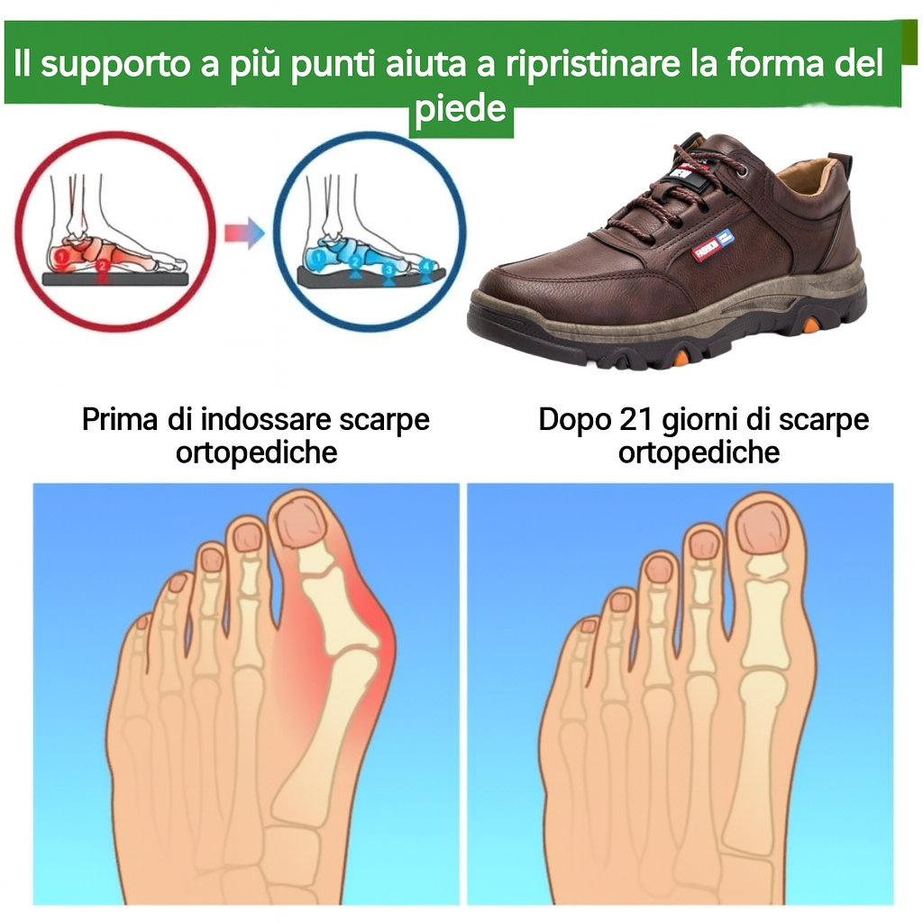 【⏰Sconto del 30% oggi - Scade presto】Scarpe ortopediche dal design ergonomico - Pelle di alta qualità + Cucite a mano ✅ Calzata comoda, impermeabili e antiscivolo👞