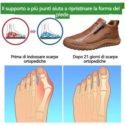 🐂 Scarpe da uomo in pelle di vitello, cucite a mano in Australia ✅ Scarpe ortopediche recentemente migliorate: facili da indossare e da togliere 👞 Impermeabili e antiscivolo