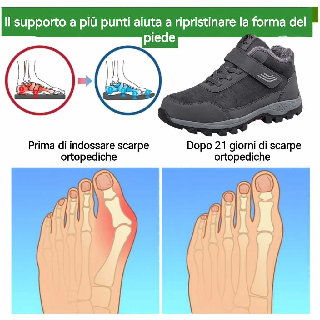 🔥Sconto del 30% a tempo limitato⏰ Scarpe ortopediche in pelle scamosciata di un marchio australiano di lusso, morbide, comode e con un supporto eccellente🦶 - Impermeabili e antiscivolo