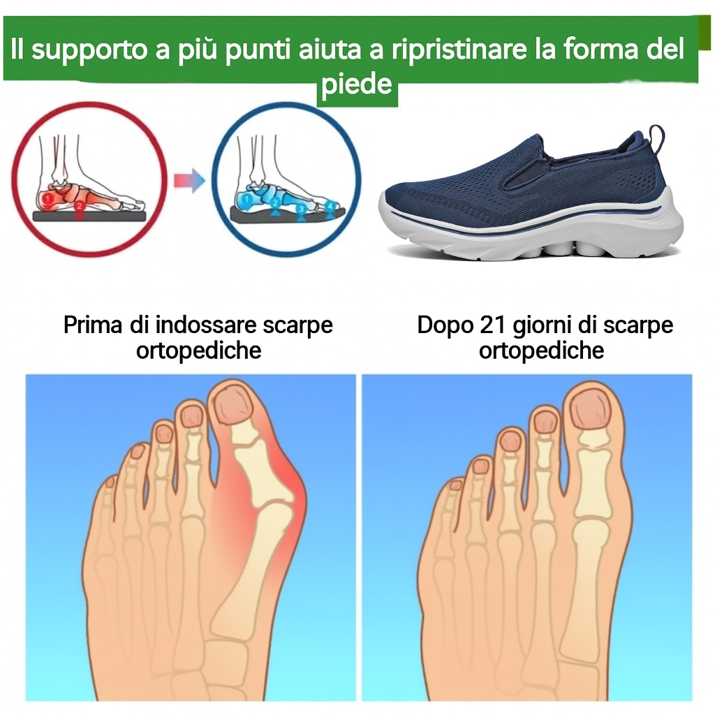 🔥Scarpe ortopediche dal design ergonomico⏰ Scarpe in mesh leggere e traspiranti👞 Gamma completa di taglie: cammina con sicurezza