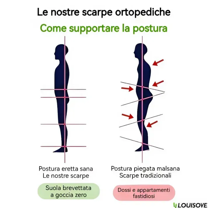 [🎁Sconti primaverili a metà prezzo - da non perdere] Sandali ortopedici dal design ergonomico - camminata indolore👞Goditi il ​​comfort di camminare tra le nuvole