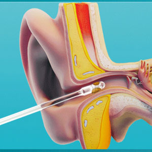 48 large capacity units