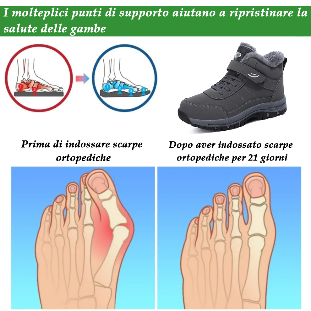 🔥Sconto del 50% per un periodo limitato⏰ Scarpe ortopediche in pelle scamosciata di un marchio australiano di lusso, morbide, comode e con un supporto eccellente🦶 - Impermeabili e antiscivolo
