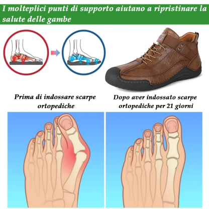 (🔥Sconto del 50% oggi - Non lasciartelo sfuggire!) - 🐂Scarpe comode ed eleganti in pelle di vitello 👞(antiscivolo, supporto plantare per alleviare il dolore)