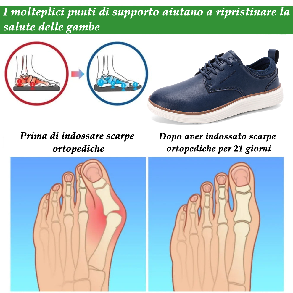 (🔥Sconto del 50% per un periodo limitato!) - Scarpe ortopediche Luymen® in vera pelle, comode ed eleganti 👞 (impermeabili, antiscivolo, supporto dell'arco plantare, camminata facile)