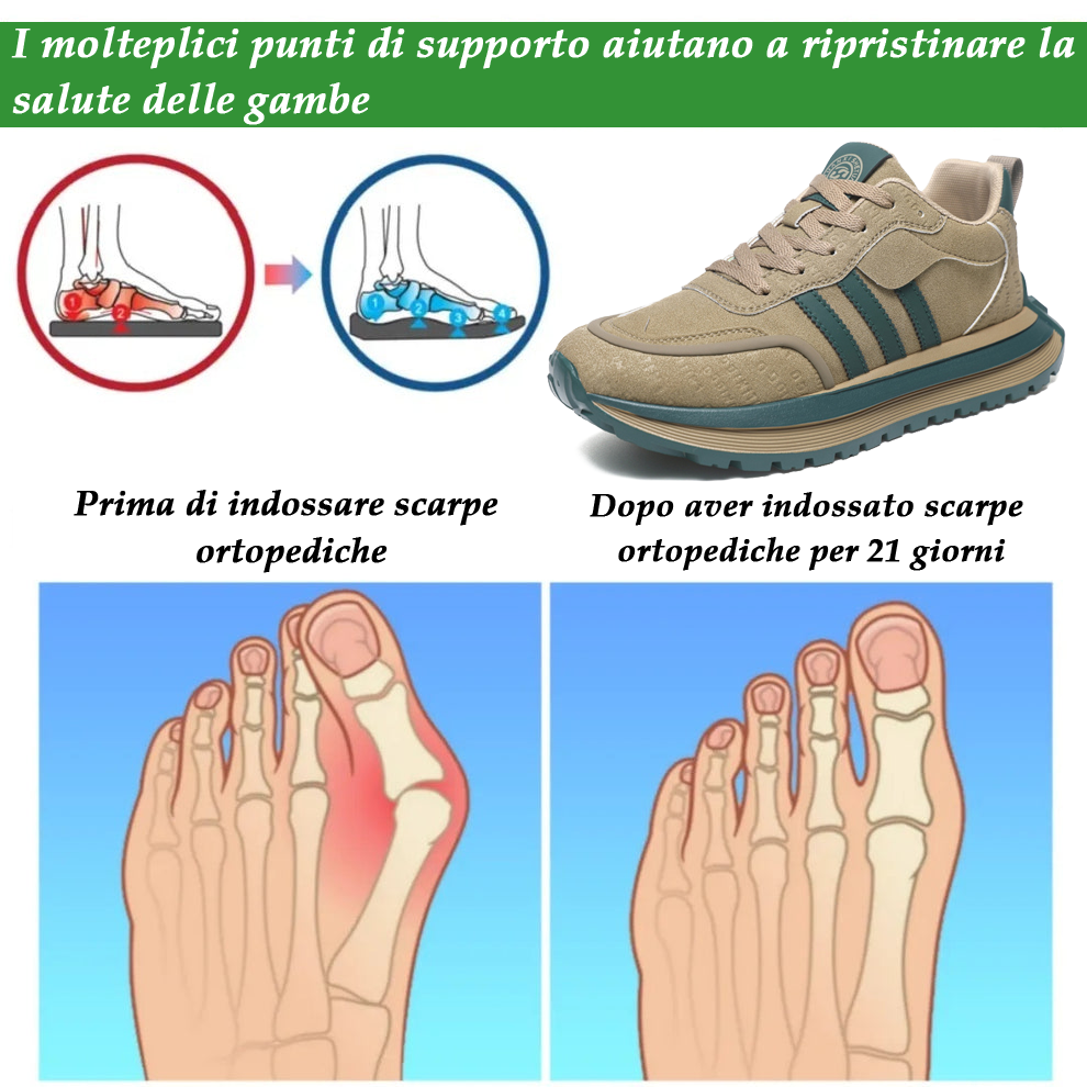 (🔥 Sconto del 50% - Non lasciartelo sfuggire!) Sneakers Ergonomiche LUYMEN - Massimo Supporto e Suola Antiscivolo - Cammina Senza Dolore