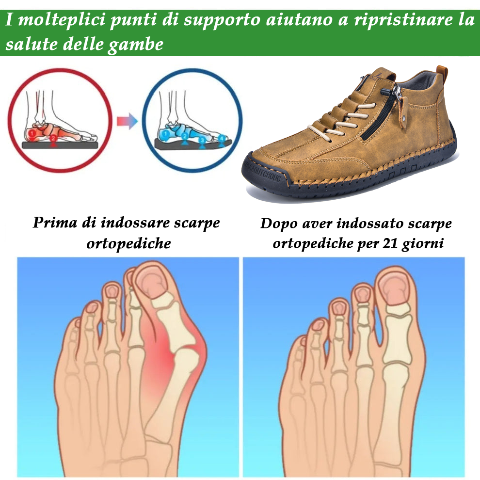 (🔥 Sconto del 50% - Non lasciartelo sfuggire!)Scarpe in Pelle "Zero Fatica": Zip Laterale, Supporto Plantare e suola antiscivolo – il design ergonomico allevia la fatica.