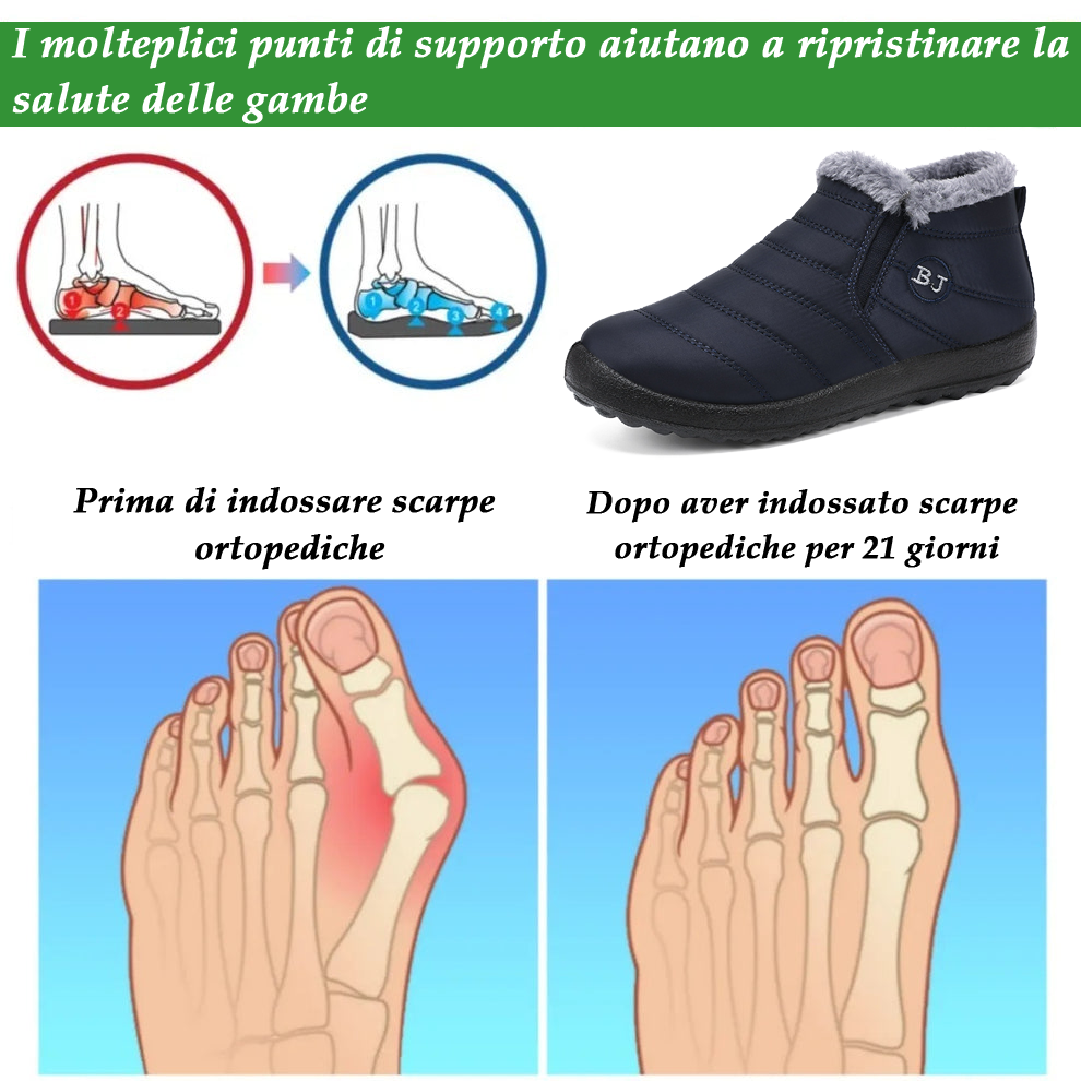 (🔥Offerta a tempo limitato⏰) Scarpe ortopediche calde invernali🦶 – Impermeabili e antiscivolo – Progettate ergonomicamente per alleviare il dolore ai piedi – Unisex