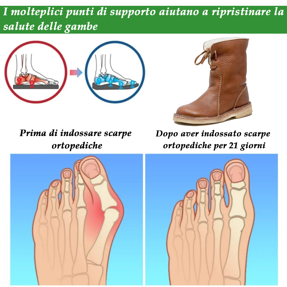 (🔥Sconto del 50% a tempo limitato - Non lasciartelo sfuggire!)⏰ - Stivali in pelle calda, morbidi e comodi in stile retrò (con supporto plantare per camminare più facilmente)