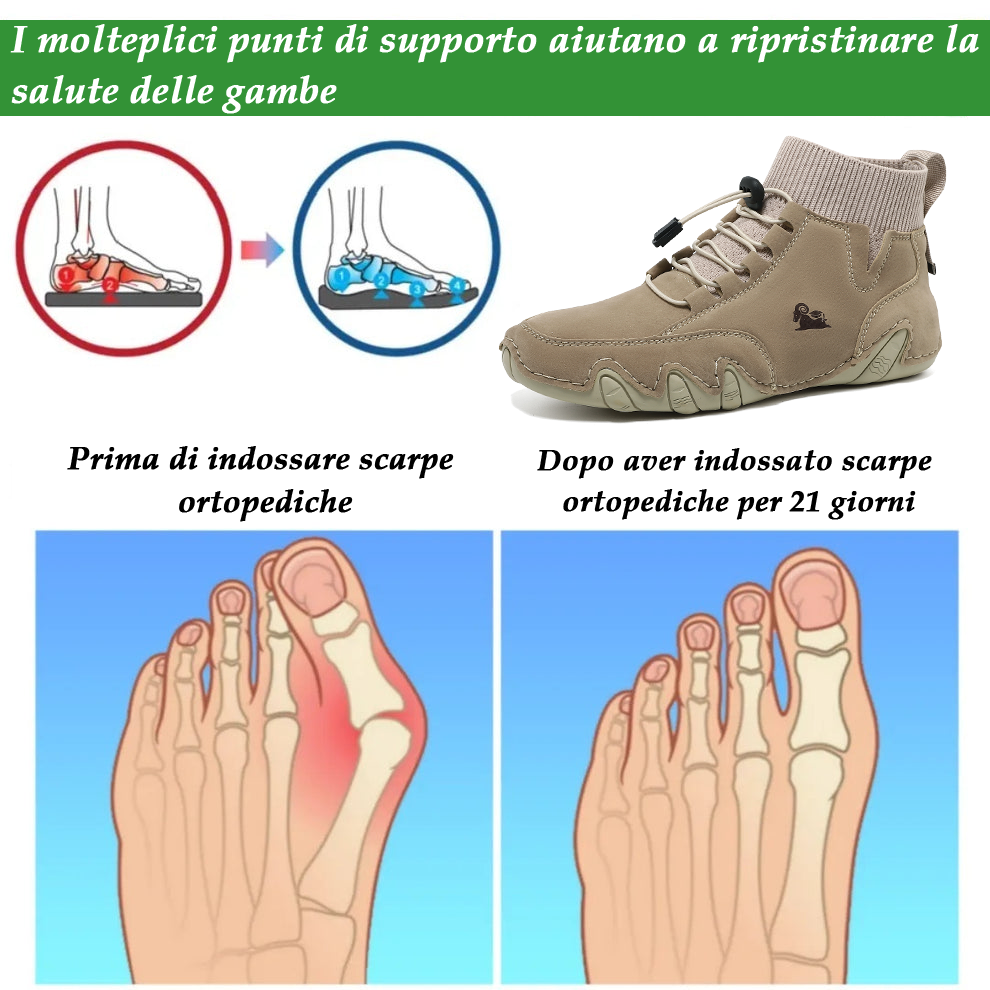 (🔥Sconto del 50% oggi, non lasciartelo sfuggire!)⏰ - Scarpe da trekking casual morbide e comode - Supporto dell'arco plantare - Sollievo dal dolore (unisex)