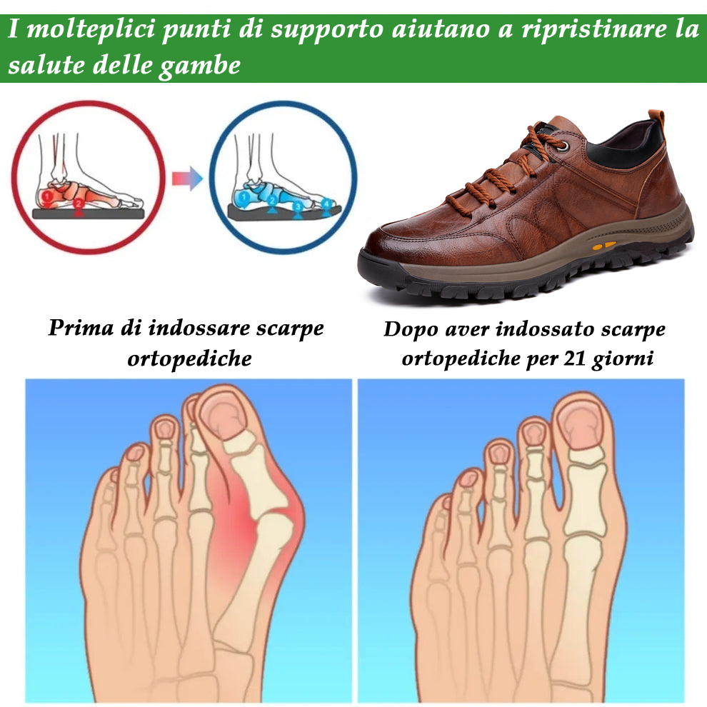 (🔥Sconto del 50% oggi - non perdertelo!) - Scarpe in pelle di vitello italiana morbide e comode - Supporto dell'arco plantare - Sollievo dal dolore