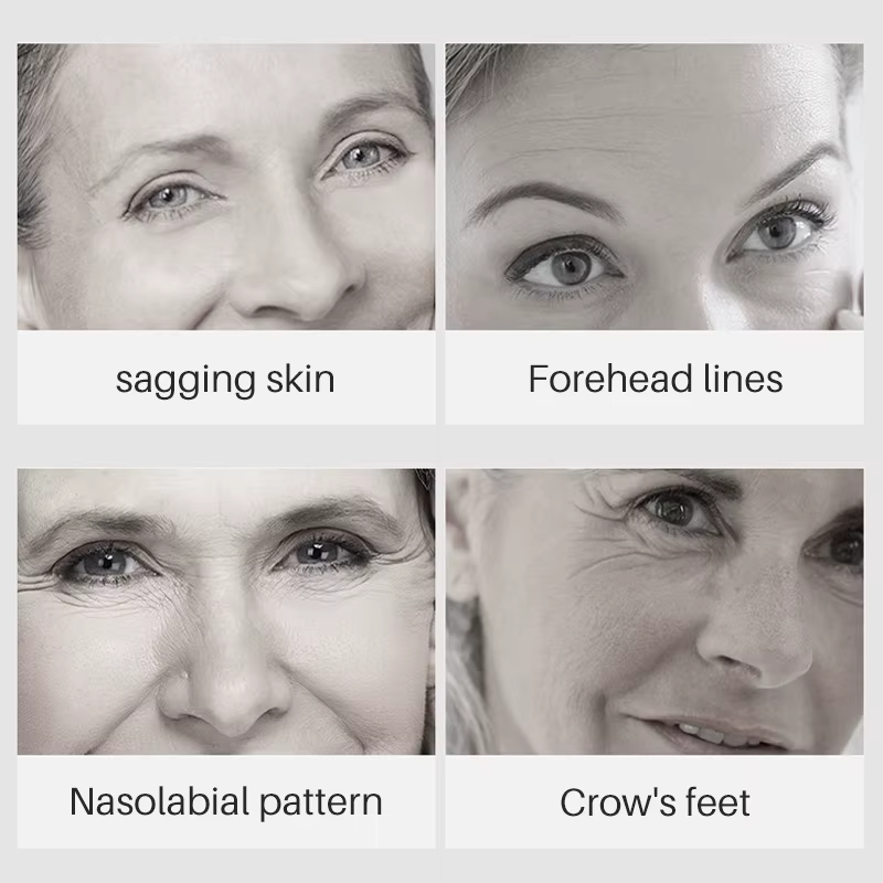 Acne Dark Patches Acne Bright Skin Dark Spot Corrector Body Face Turmeric Oil Serum-Chingo