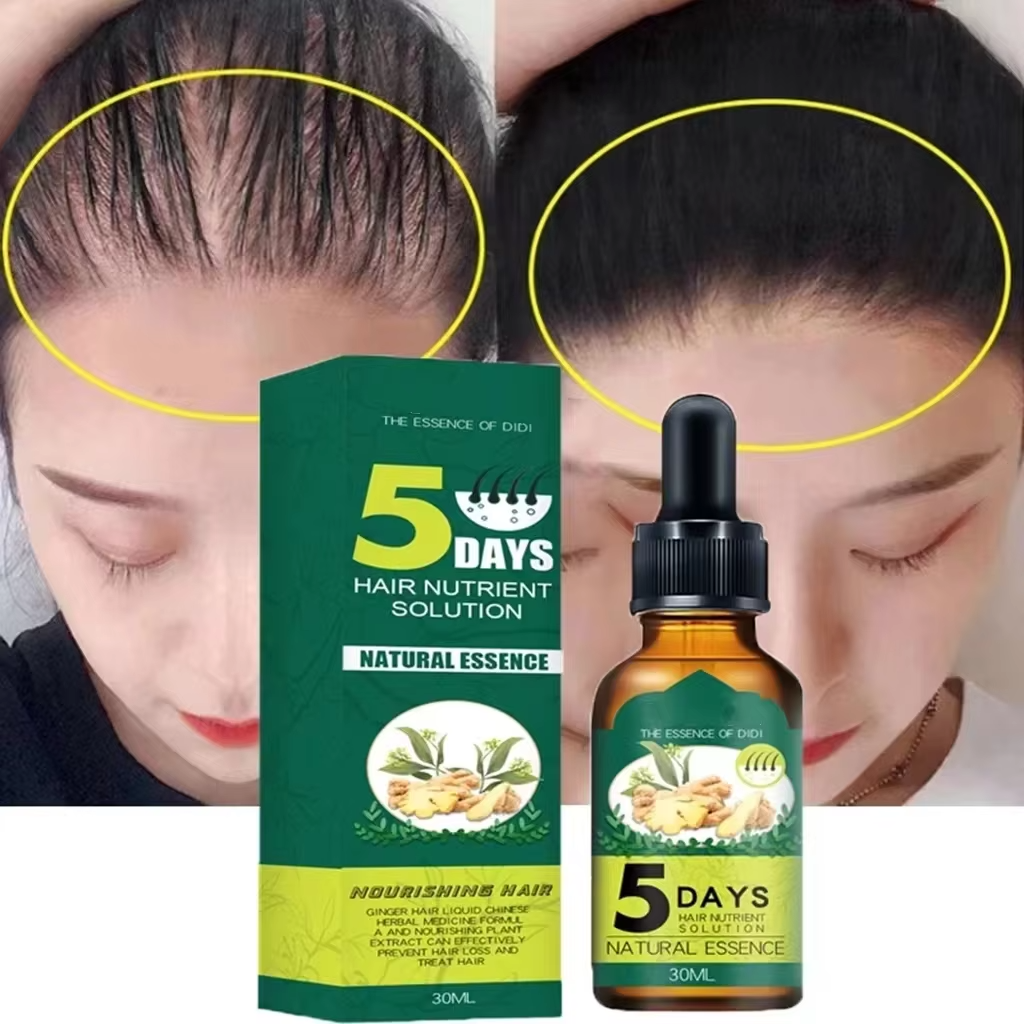 Fast Growth Anti-Hair Loss Serum-Chingo