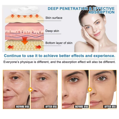 Collagen Mask Bio Collagen Pore Minimizing Real Deep Mask-Chingo