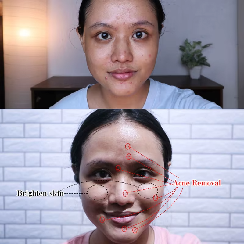 Acne Dark Patches Acne Bright Skin Dark Spot Corrector Body Face Turmeric Oil Serum-Chingo