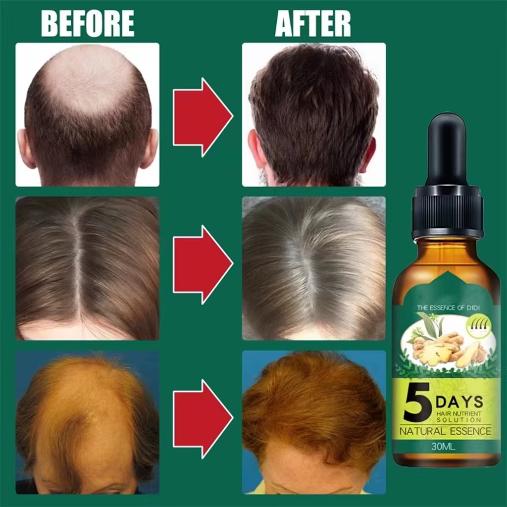 Fast Growth Anti-Hair Loss Serum-Chingo