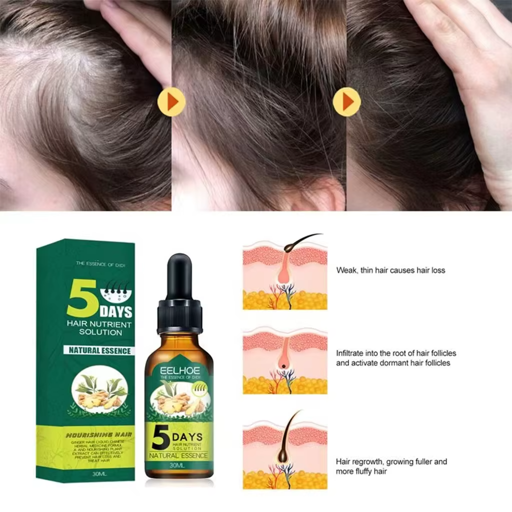 Fast Growth Anti-Hair Loss Serum-Chingo